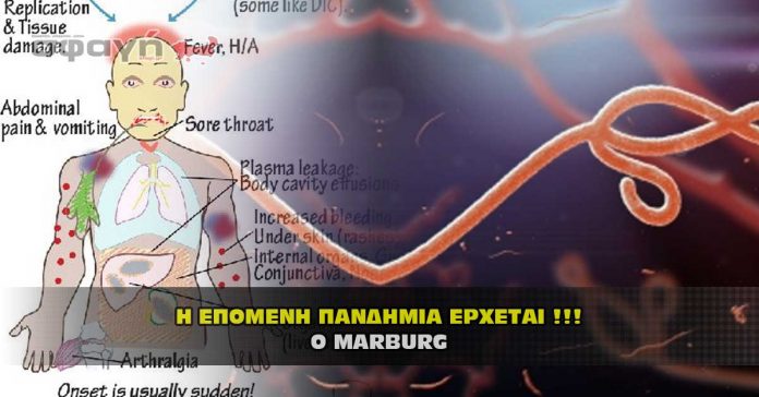 Έρχεται η επόμενη πανδημία. Ο Marburg που είναι ο ενισχυμένος Ebola.